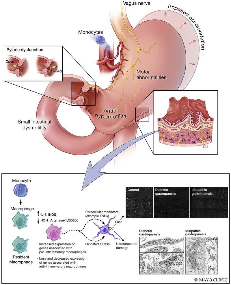 2D Trans-illumination Intestine Projection Imaging of intestinal motility in mice. (Grover, 2019)